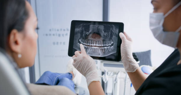 Licensed Dental Implants service in Lawton, MI - Smile Center Dentistry